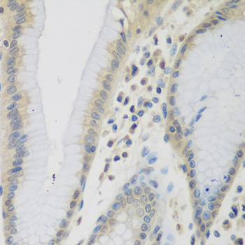 Immunohistochemistry - CCL26 Polyclonal Antibody 