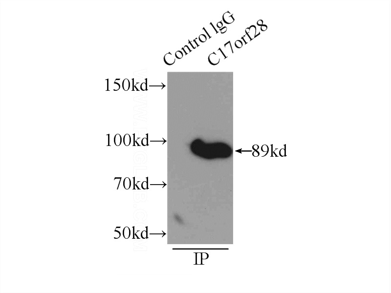 IP Result of anti-C17orf28 (IP:Catalog No:108612, 3ug; Detection:Catalog No:108612 1:500) with mouse brain tissue lysate 10000ug.