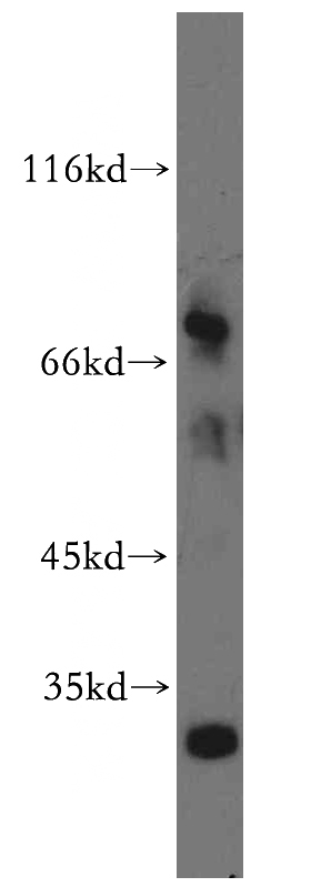 U-937 cells were subjected to SDS PAGE followed by western blot with Catalog No:112562(MCSF antibody) at dilution of 1:200