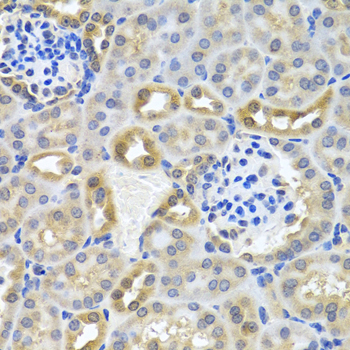 Immunohistochemistry - DEDD Polyclonal Antibody 