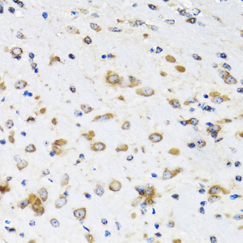 Immunohistochemistry - COPB2 Polyclonal Antibody 