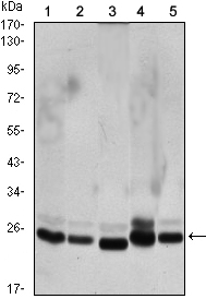 Western blot analysis using CBX1 mouse mAb against Hela (1), COS7 (2), NIH/3T3 (3), A431 (4),and C6 (5) cell lysate.
