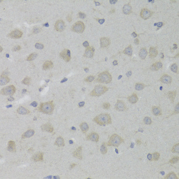 Immunohistochemistry - HSD17B13 Polyclonal Antibody 
