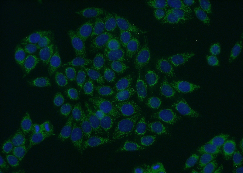 Immunofluorescent analysis of HeLa cells using Catalog No:107801(ABCD1 Antibody) at dilution of 1:50 and Alexa Fluor 488-congugated AffiniPure Goat Anti-Rabbit IgG(H+L)