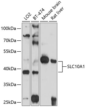 Western blot - SLC10A1 Polyclonal Antibody 