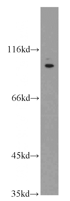 SH-SY5Y cells were subjected to SDS PAGE followed by western blot with Catalog No:116417(TRPV4 antibody) at dilution of 1:800