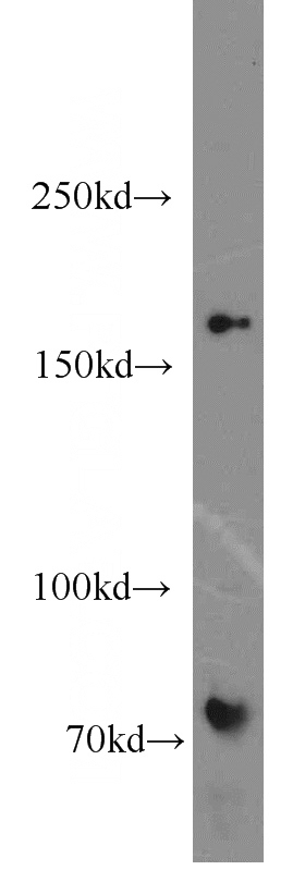 mouse heart tissue were subjected to SDS PAGE followed by western blot with Catalog No:112505(MBD5 antibody) at dilution of 1:500