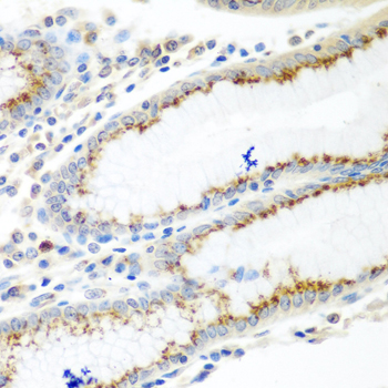 Immunohistochemistry - UBIAD1 Polyclonal Antibody 