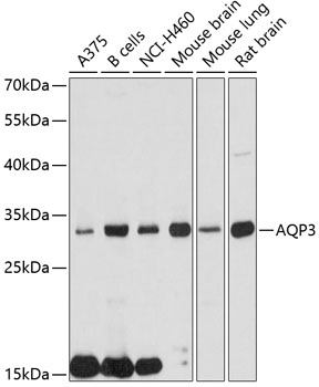 Western blot - AQP3 Polyclonal Antibody 