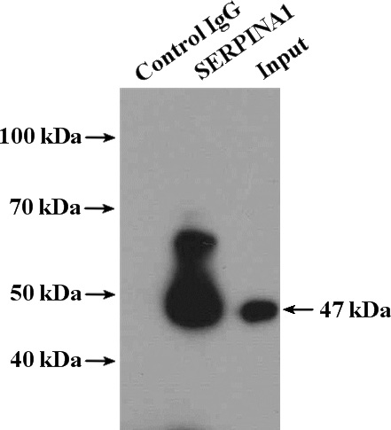 IP Result of anti-Alpha-1-Antitrypsin (IP:Catalog No:107875, 4ug; Detection:Catalog No:107875 1:1000) with mouse kidney tissue lysate 7200ug.