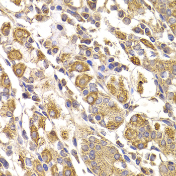Immunohistochemistry - METTL7B Polyclonal Antibody 