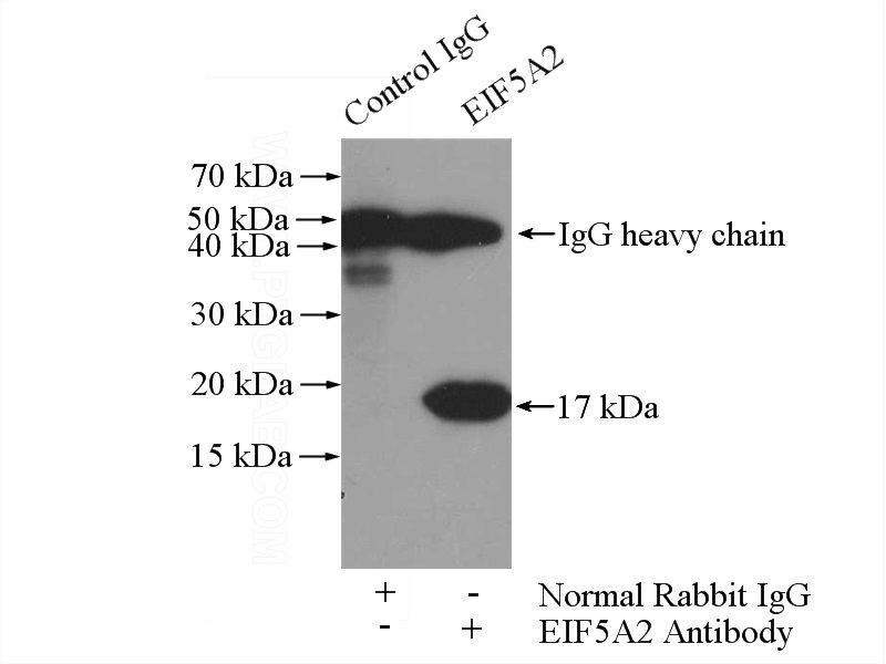 IP Result of anti-EIF5A2 (IP:Catalog No:110268, 3ug; Detection:Catalog No:110268 1:500) with mouse brain tissue lysate 4000ug.