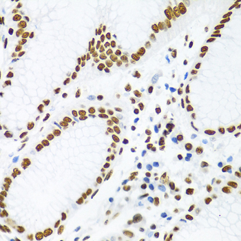 Immunohistochemistry - KHDRBS1 Polyclonal Antibody 