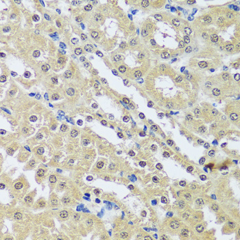Immunohistochemistry - C12orf10 Polyclonal Antibody 