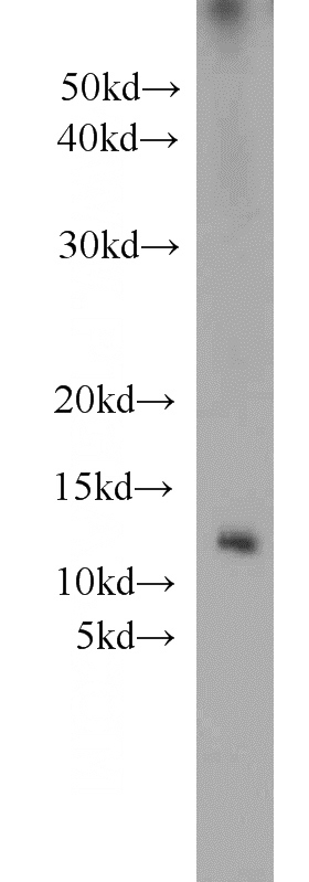 mouse pancreas tissue were subjected to SDS PAGE followed by western blot with Catalog No:116576(Uroguanylin antibody) at dilution of 1:1000