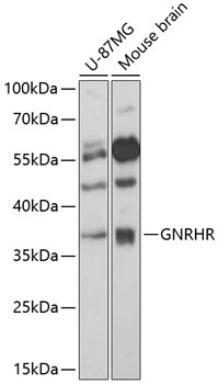 Western blot - GNRHR Polyclonal Antibody 
