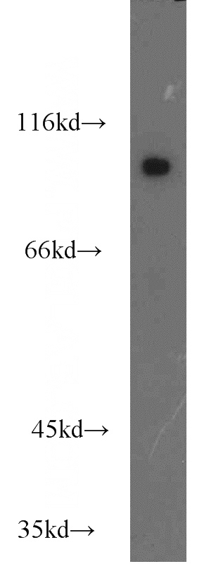 mouse heart tissue were subjected to SDS PAGE followed by western blot with Catalog No:109459(COPG2 antibody) at dilution of 1:1000