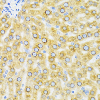 Immunohistochemistry - EDA Polyclonal Antibody 