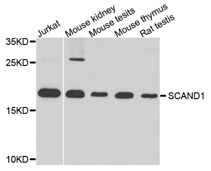 Western blot - SCAND1 Polyclonal Antibody 