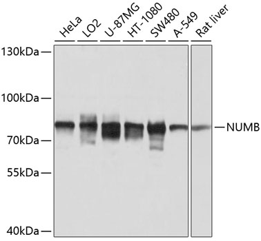 Western blot - NUMB Polyclonal Antibody 