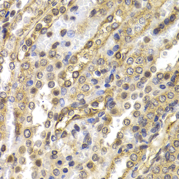 Immunohistochemistry - NEDD9 Polyclonal Antibody 