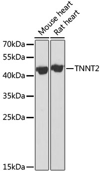Western blot - TNNT2 Polyclonal Antibody 