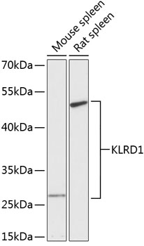 Western blot - KLRD1 Polyclonal Antibody 