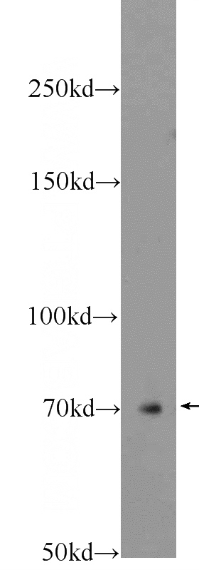 rat brain tissue were subjected to SDS PAGE followed by western blot with Catalog No:116647(Ubiquilin 1 Antibody) at dilution of 1:300