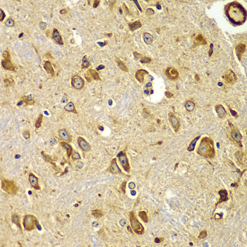 Immunohistochemistry - SMAD9 Polyclonal Antibody 