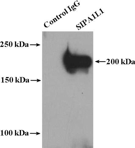 IP Result of anti-SIPA1L1 (IP:Catalog No:115237, 4ug; Detection:Catalog No:115237 1:1500) with mouse brain tissue lysate 4000ug.