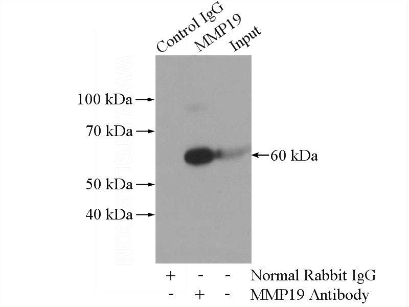 IP Result of anti-MMP19 (IP:Catalog No:112699, 4ug; Detection:Catalog No:112699 1:500) with human placenta tissue lysate 1520ug.