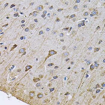 Immunohistochemistry - DRD3 Polyclonal Antibody 