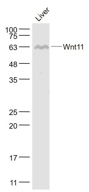 Fig4: Sample:; Liver (Mouse) Lysate at 40 ug; Primary: Anti- Wnt11 at 1/1000 dilution; Secondary: IRDye800CW Goat Anti-Rabbit IgG at 1/20000 dilution; Predicted band size: 36 kD; Observed band size: 63 kD