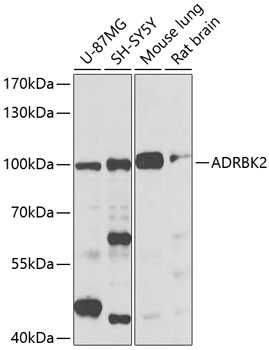 Western blot - ADRBK2 Polyclonal Antibody 