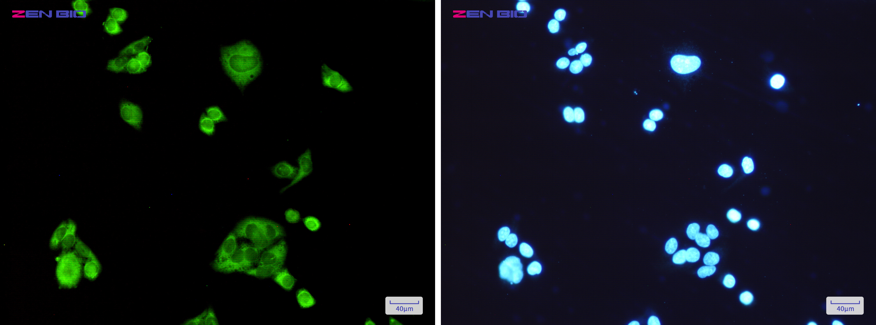 Immunocytochemistry of PGD(green) in Hela cells using PGD Rabbit mAb at dilution 1/200, and DAPI(blue)