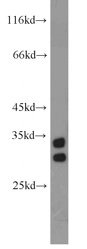 human testis tissue were subjected to SDS PAGE followed by western blot with Catalog No:113394(NT5C3L antibody) at dilution of 1:800