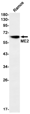 Western blot detection of ME2 in Ramos cell lysates using ME2 Rabbit mAb(1:1000 diluted).Predicted band size:65kDa.Observed band size:65kDa.