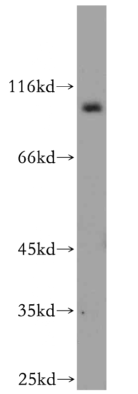 mouse brain tissue were subjected to SDS PAGE followed by western blot with Catalog No:115082(SEC5 antibody) at dilution of 1:500