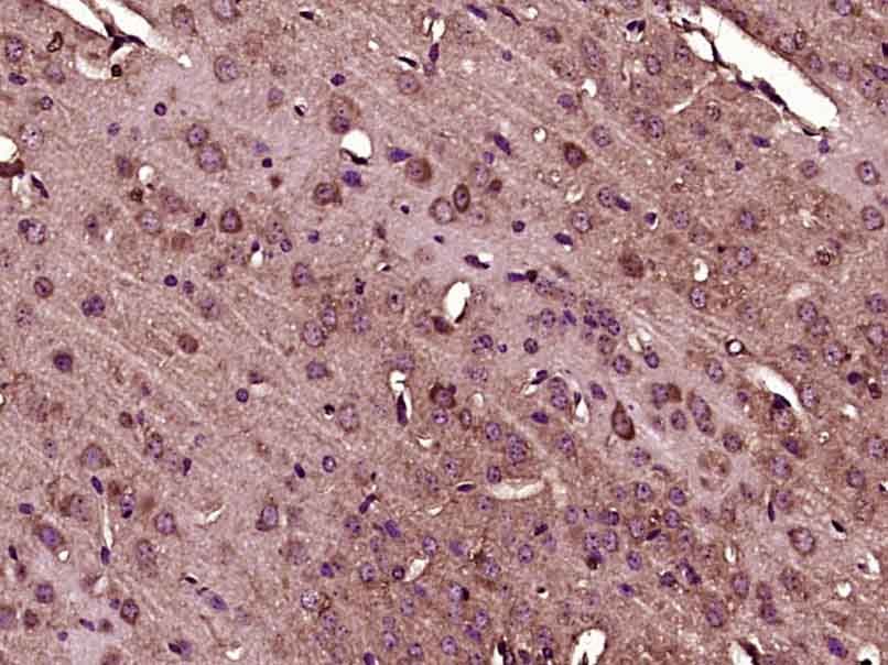 Fig2: Paraformaldehyde-fixed, paraffin embedded (Mouse brain); Antigen retrieval by boiling in sodium citrate buffer (pH6.0) for 15min; Block endogenous peroxidase by 3% hydrogen peroxide for 20 minutes; Blocking buffer (normal goat serum) at 37℃ for 30min; Antibody incubation with (ADAMTS7(NT)) Polyclonal Antibody, Unconjugated at 1:400 overnight at 4℃, followed by operating according to SP Kit(Rabbit) (sp-0023) instructionsand DAB staining.