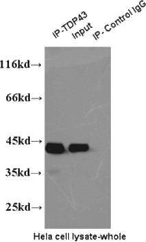 IP result of anti-TDP43(Catalog No:115925 for IP and Catalog No:107618 for Detection).