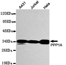 Western blot detection of PPP1A in A431,Jurkat and Hela whole cell lysates using PPP1A mouse mAb (1:1000 diluted).Predicted band size: 38KDa.Observed band size: 38KDa.