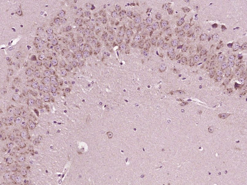 Fig2: Paraformaldehyde-fixed, paraffin embedded (Mouse brain); Antigen retrieval by boiling in sodium citrate buffer (pH6.0) for 15min; Block endogenous peroxidase by 3% hydrogen peroxide for 20 minutes; Blocking buffer (normal goat serum) at 37℃ for 30min; Antibody incubation with (Sodium hydrogen exchanger 1) Polyclonal Antibody, Unconjugated at 1:400 overnight at 4℃, followed by operating according to SP Kit(Rabbit) (sp-0023) instructionsand DAB staining.