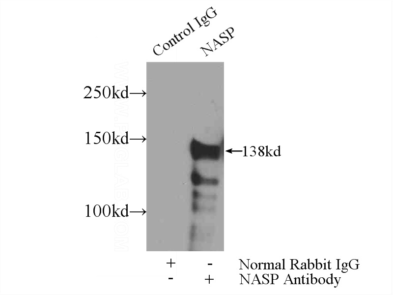 IP Result of anti-NASP (IP:Catalog No:112958, 5ug; Detection:Catalog No:112958 1:1000) with mouse testis tissue lysate 4000ug.