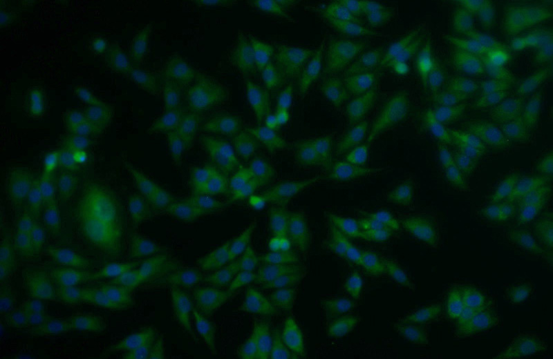 Immunofluorescent analysis of A375 cells using Catalog No:115648(SPRY2 Antibody) at dilution of 1:25 and Alexa Fluor 488-congugated AffiniPure Goat Anti-Rabbit IgG(H+L)
