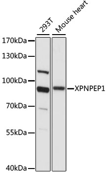 Western blot - XPNPEP1 Polyclonal Antibody 