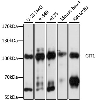 Western blot - GIT1 Polyclonal Antibody 