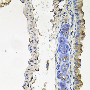 Immunohistochemistry - NDUFA6 Polyclonal Antibody 