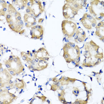 Immunohistochemistry - RBP2 Polyclonal Antibody 