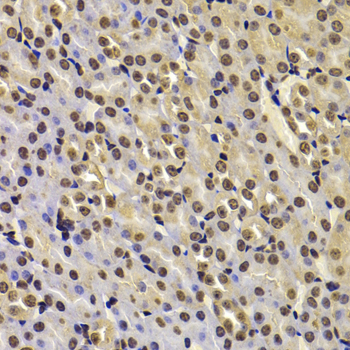 Immunohistochemistry - FBXW7 Polyclonal Antibody 