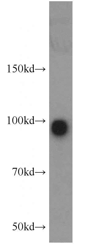 mouse brain tissue were subjected to SDS PAGE followed by western blot with Catalog No:114064(SH3RF1 antibody) at dilution of 1:1000